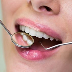 General Dentristy Dentist - Wallan Dentist, Riddells Creek Dentist and Maribyrnong Dentist