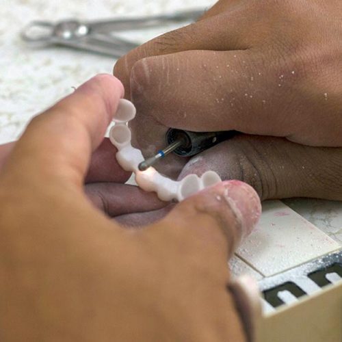 Full Mouth Reconstruction Dentist Riddells Creek Wallan Maribyrnong