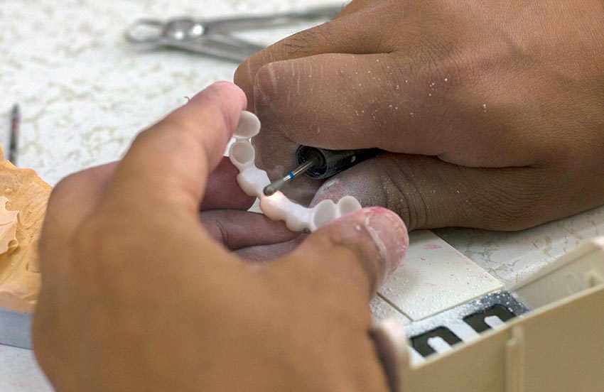 Full Mouth Reconstruction Dentist Riddells Creek Wallan Maribyrnong