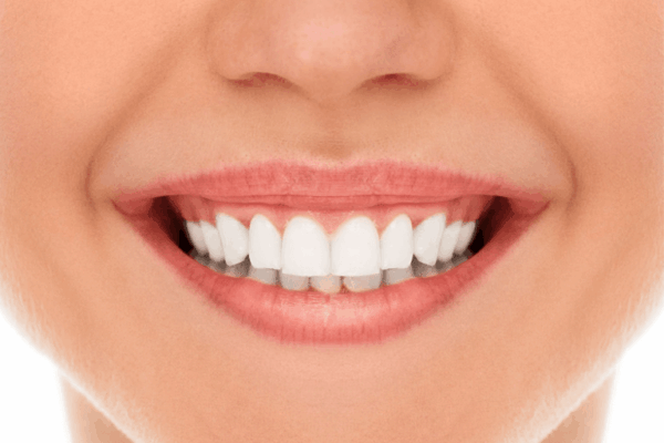 teeth-whitening